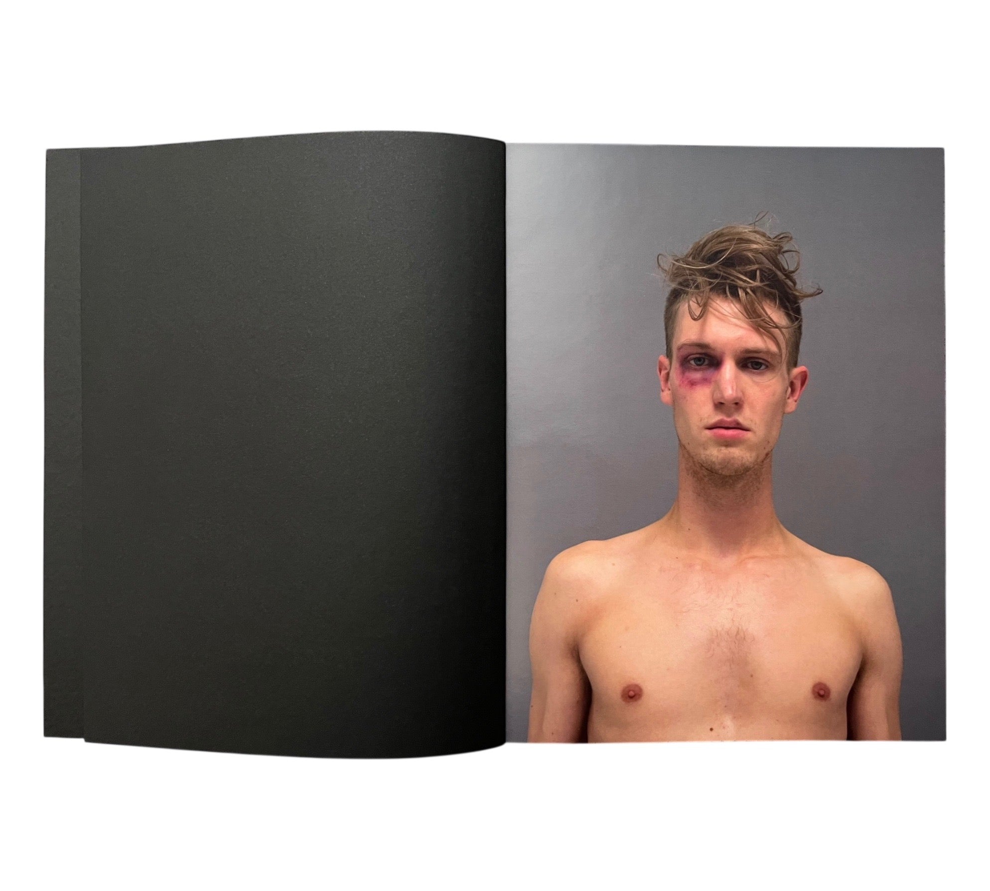 Mustafa Sabbagh: About Skin